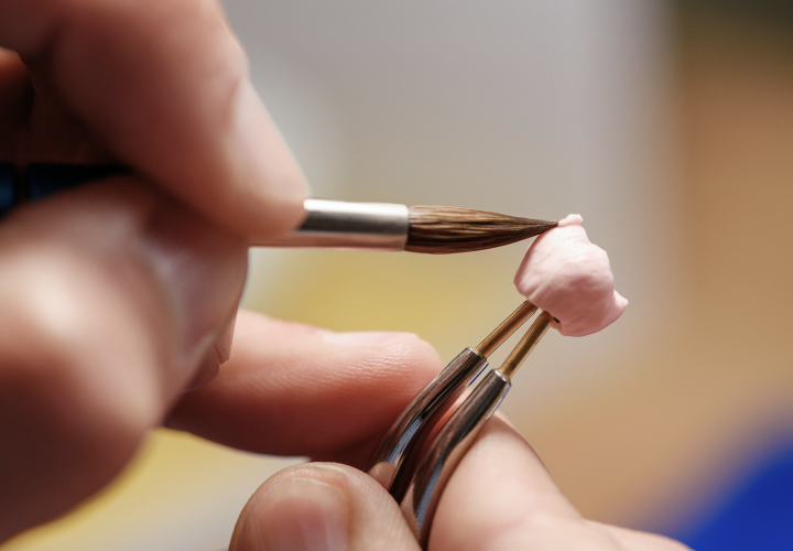 laboratoire protheses dentiste sanary Notre Cabinet Dentistes Ollioules | Cabinet dentaire Mermoz