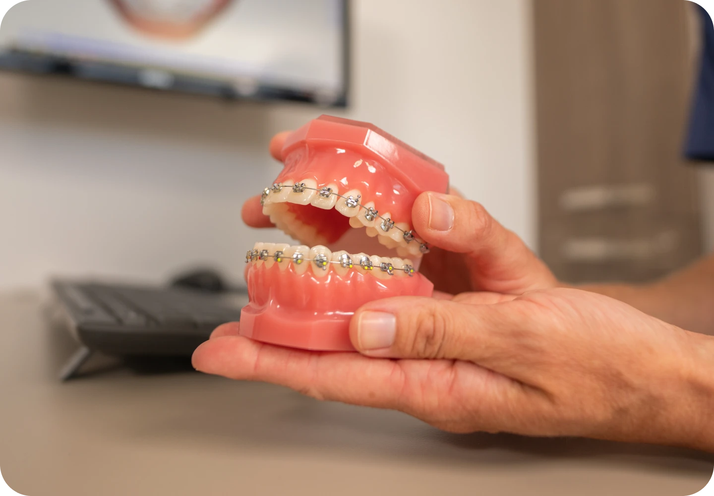 appareil dentaire ollioules Bagues dentaires Dentistes Ollioules | Cabinet dentaire Mermoz