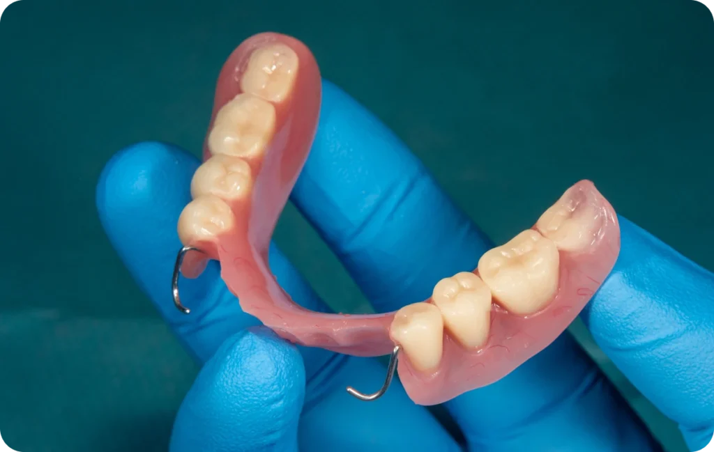 bridge dentistes ollioules Prothèses amovibles  Dentistes Ollioules | Cabinet dentaire Mermoz