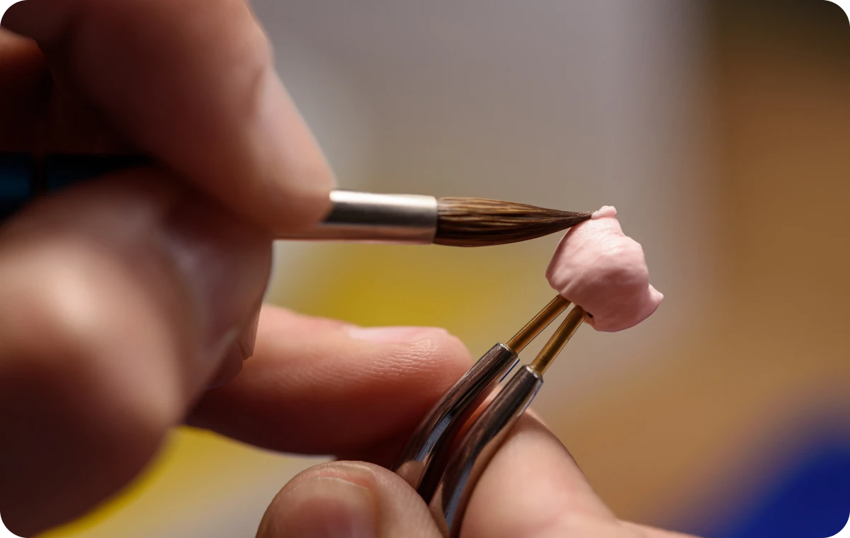 protheses dentaires dentistes ollioules Couronne Dentistes Ollioules | Cabinet dentaire Mermoz